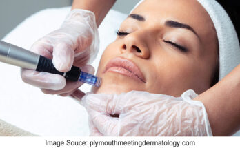 Here are some of the types of cosmetic dermatology treatments you can get